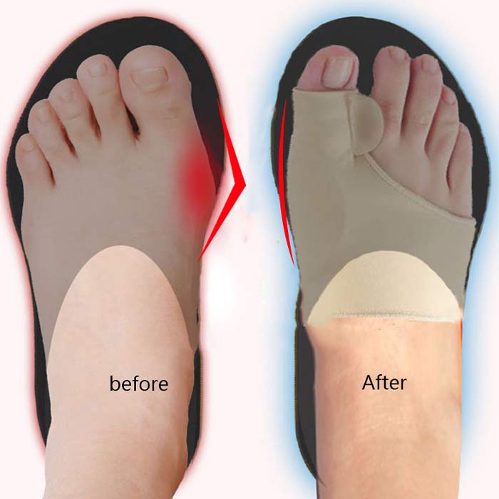 CorrectiveSocks, korekcijske nogavice - Image 3